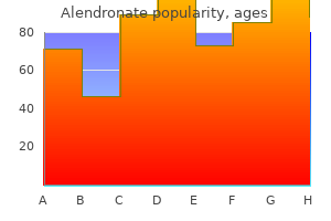 order alendronate 70 mg without prescription