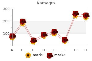 generic 50mg kamagra amex