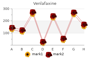 safe venlafaxine 150mg