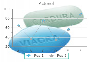 order 35 mg actonel with amex